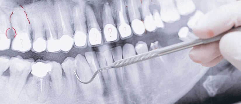 Gaziantep Oral Diagnoz ve Radyoloji